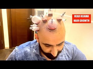 BENEFITS OF HEAD HIJAMA | FULL VIDEO |