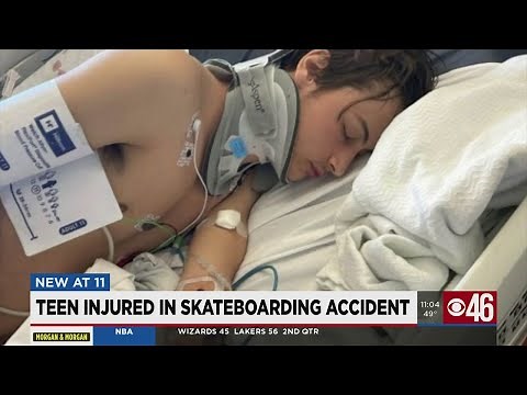 Teen injured in skateboarding accident