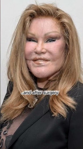 Jocelyn Wildenstein before and after surgery...