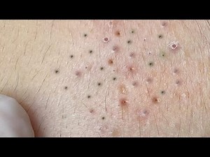 Satisfying Relaxing with Sac Dep Spa Video (#162)