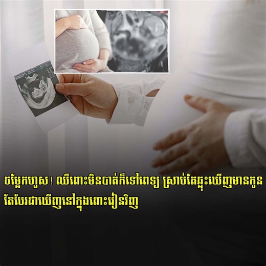 2.6K views · 66 reactions | ចម្លែកហួស! ឈឺពោះមិនបាត់ក៏ទៅពេទ្យ ស្រាប់តែឆ្លុះឃើញមានកូន តែបែរជាឃើញនៅក្នុងពោះវៀនវិញ | Popular Magazine | Facebook