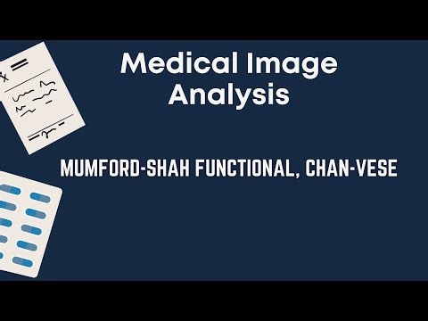 MUMFORD-SHAH FUNCTIONAL, CHAN-VESE