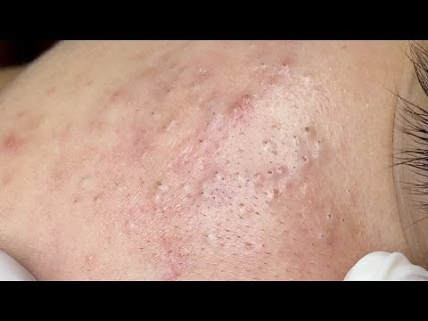 Relax Every Day With Sac Dep Spa #0363