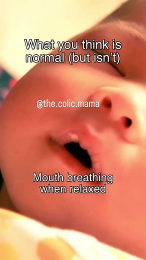 What you think is normal… but isn’t! So many parents are told “that’s just babies” — but these signs are often your baby asking for help: 👄 Mouth breathing — a sign of airway, oral function, or tension issues 🤕 Constant hiccups — not just background noise, often linked to reflux or tension 🍼 Clicking during feeds — your baby is losing suction and swallowing air 🤢 Arching their back — a classic sign of discomfort, reflux, or feeding difficulty None of these are personality traits. They’re sym