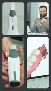 O Straumann SIRIOS™ veio para revolucionar o escaneamento intraoral....