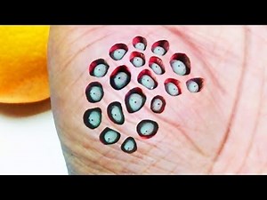 20 Worst Images for Trypophobia