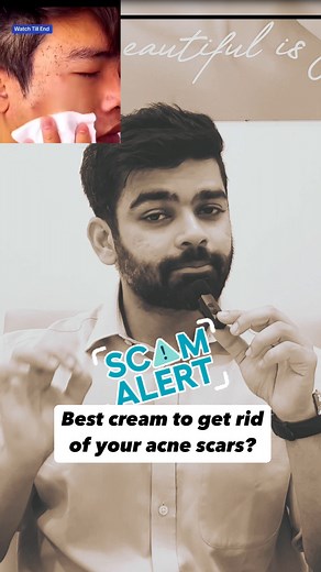 What to Do for Acne Scars (Instead of Falling for Fake Creams) 1. Consult a Dermatologist – Get a proper evaluation to determine the type of acne scars (atrophic, hypertrophic, or post-inflammatory hyperpigmentation) 2. Consider Microneedling – Stimulates collagen remodeling, improving scar depth over multiple sessions. 3. Laser Treatments – Fractional lasers or CO2 lasers target deeper scars by stimulating new skin formation. 4. Dermal Fillers – Temporary fillers can lift depressed scars for an