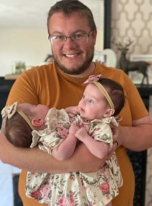 Queste gemelle sono nate nel 2022. I loro genitori avevano sognato per molti anni di avere un bambino – e ecco il miracolo: hanno avuto due bambine contemporaneamente. Tuttavia, alla 12ª settimana di gravidanza, si è scoperto che le bambine erano unite a livello del torace e del bacino. Gemelle siamesi come loro nascono circa una volta ogni 2,5 milioni di gravidanze, e la loro esistenza è considerata un vero miracolo. Fortunatamente, ciascuna bambina aveva il proprio cuore, il che ha permesso di