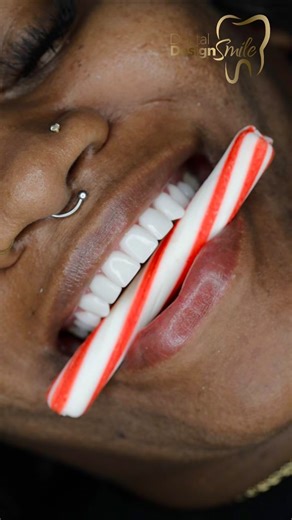 Our greatest accomplishment is giving every patient the chance to achieve a radiant smile—one that can transform their professional, personal, and romantic lives. At Dental Design Smile, we are committed to making your dream smile a reality. ✨🦷 👇🏻 For more details or to book your appointment, contact us: 📱 786-452-1922 Visit us at: 📍 11980 SW 8th St, Miami, Florida 📍 103 Greene St, 2nd Fl, Jersey City, NJ 07302 #DentalDesignSmile #PerfectSmile #SmileTransformation #CosmeticDentistry #Denta