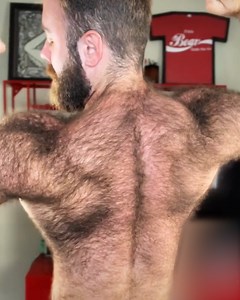 People Described Him As A “Real-Life Werewolf”, This Is His Story | Boys do it too