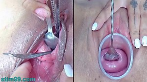 Milf Lesbians Cervix and Urethral Penetration