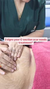 325K views · 2.3K reactions | Agar C-section ke baad pain, itching,...