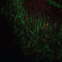 Video: Visualizing Angiogenesis by Multiphoton Microscopy In Vivo in Genetically Modified 3D-PLGA/nHAp Scaffold for Calvarial Critical Bone Defect Repair