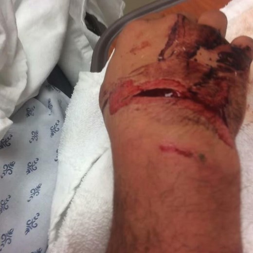 Shepherd man survives attack by grizzly bear