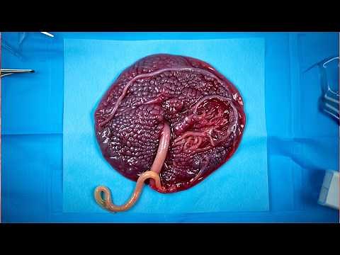 How the Placenta Forms and Works