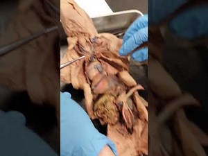 Fetal Pig Arteries & Veins (Mrs. Haynoski)