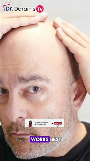 Why Men Lose Their Hair: The Truth No One Tells You