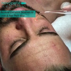 Men can and should pamper their skin too! 😎 Get some lift and glow into skin with Novopelle SPA treatments😉💁‍♀️ . . . #chemicalpeel #plasmaion #medspa #bodycontouring #botox #professionalskincare #antiaging #lipo #fatremoval #microneedling #lipfillers #medicalspa #facials #prpfacial #bbglow #bbglowtreatment #laserhairremoval #intimatebleach #skintightening #motivation #fatloss #wellness #healthandwellness #coolsculpting #skintightening #aesthetic #injections #cosmeticsurgery #dallasmedspa | N