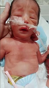 Newborn Baby Nebulization Therapy & Incubator Care | NICU Breathing Support | Educational Video