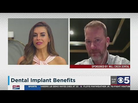 Benefits of dental implants