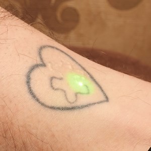 Easy Tattoo Removal | Science, Tech and Universe