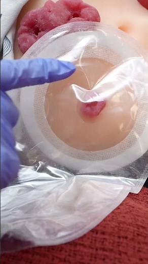 Let's go over ostomy bag application! #nursing #nurse #healthcare #clinicalskills