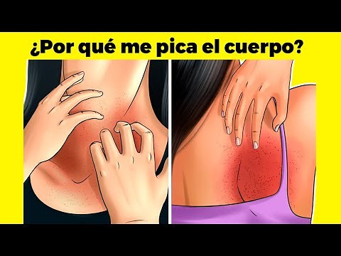 ¿Por qué me pica el cuerpo (comezón) y cómo se trata?