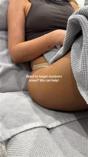 🔥 Say goodbye to stubborn fat — without needles, surgery, or downtime! 🔥⁠ ⁠ Cryolipolysis Fat Freezing is the non-invasive treatment everyone’s talking about — and for good reason:⁠ 1️⃣ Eliminate up to 40% of fat cells in treated areas — permanently⁠ 2️⃣ No downtime — head back to work or life straight after⁠ 3️⃣ TGA-approved tech for safety and results⁠ 4️⃣ Custom plans to target your trouble zones⁠ 5️⃣ Proven results you can actually see⁠ ⁠ 💥 SPECIAL OFFER:⁠ Single Applicators – Only $179⁠ 