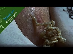 Make Your Day Relaxing with Windy Spa#6