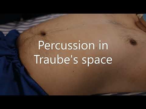 Clinical Methods of Spleen Examination | Dr Arvind Kumar