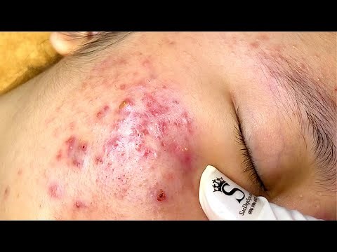 Relax Every Day With Sac Dep Spa #0029