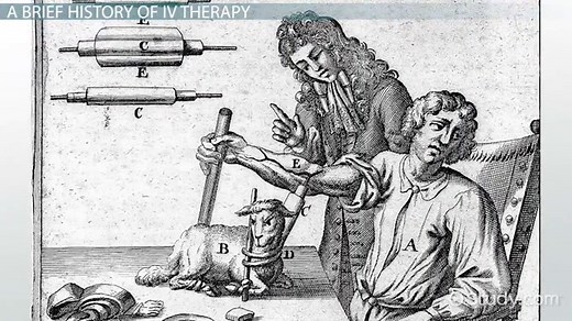 What is IV Therapy? - Definition, History, Types & Complications