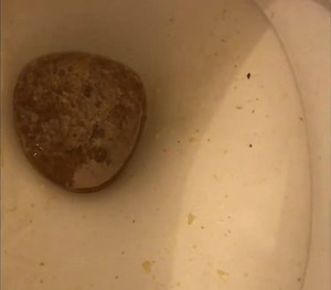 Girl puking in toilet POV