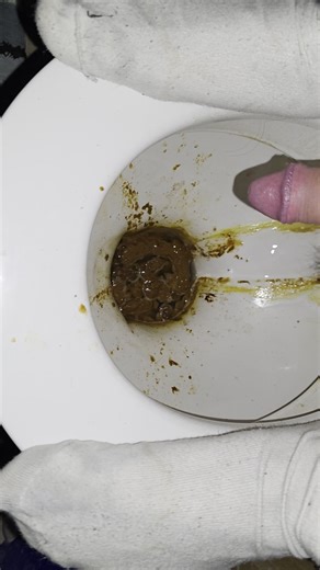 Laxative Diarrhea part 1