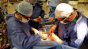 Open heart surgery