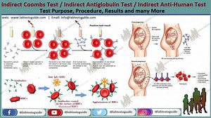 Indirect Coombs Test Types, Purpose, Procedure, Result Interpretation