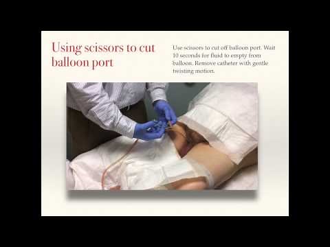 How to Remove a Catheter at Home