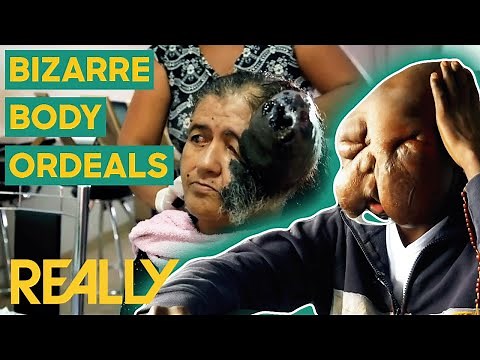 The Most Shocking Medical Cases of Season 5 | Body Bizarre