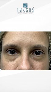 Imagos Plastic Surgery on Reels | Facebook