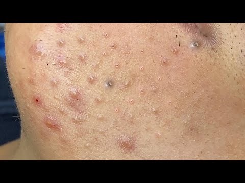 Satisfying Relaxing with Sac Dep Spa Video (#166)