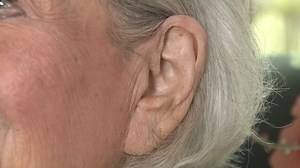 A Medication That Could Reverse Hearing Loss