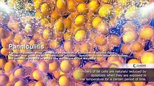 الان ولاول مرة في كركوك جهاز CLATUU لتجميد الدهون في مركز إيزي ديرم باشراف الدكتورات د إسراء -- د سنبل -- د إقبال ‏((Clatuu)) تجميد الدهون ‏Cryolipolysis هو اول تقنيه معتمدة دولياً للتخلص من الدهون بدون جراحة الكرايو معتمد من منظمه الدواء الامريكية واحد من احدث الاجهزه في عالم التنحيف ‏"Clatuu" يتميز عن بقية اجهزة التنحيف التي تعمل بمبدأ الكريو ‏Cryolipolysis باستخدام تقنية الإحاطة الكاملة للنسيج360 درجة والتحطيم المتكامل للدهون وجهاز clatuu الوحيد بالعالم الذي يتمتع بهذه الخاصية جلسة بدون الم ف