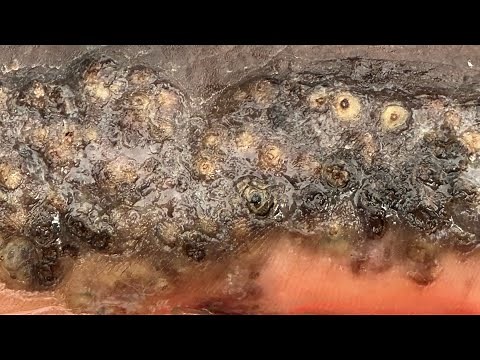 Nehemiah's follow up jigger digging - worst attack ever, with scales rot and bad smells