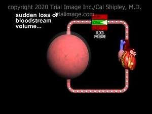 Shock Animation by Cal Shipley, M.D.