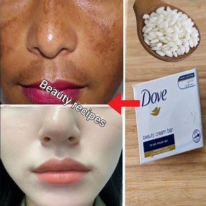 48K views · 637 reactions | Mix Dove soap with rice to get rid of pigmentation and dark spots. A secret that no one will tell you. Thank me later #glowing skin #anti-aging #natural #recipes | Beauty recipes | Facebook