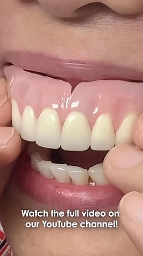 82K views · 83 comments | Finalizing an Esthetic Denture! Watch the full video on our YouTube channel! https://youtu.be/EXKUeFnBsiU #reel #reelsvideo #reels #youtube #video #denture #esthetic #final #finalize #dental #dentist #dentaltech #lukekahng #lsk121 #lsk121oralprosthetics #restoration #dentalrestoration #dentaltechnician #dentaltechnicians #patient #visit #visitingpatient #patientvisit #visiting #esthetics #dentures #upper #maxillary #fit #fitting | CEO Luke Kahng | Facebook