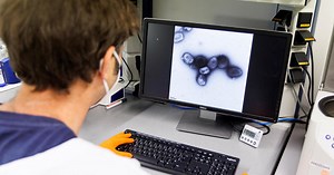 WHO studying monkeypox transmission