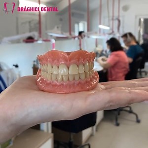 #OurDailyWork: Proteze Candulor cu dinți din compozit Candulor este un sistem elvețian de proteze mobile din materiale premium, care oferă succiune îmbunătățită și estetică maximă, imitând perfect gingia pacientului. Acest tip de proteză este recomandat pentru cazurile cu edentație totală. Laboratorul Drăghici Dental | Iaşi, Valea Lupului, DN 28 ☎️ 0763 978 786 📧 laborator@draghicidental.ro | Drăghici Dental - Tehnică Dentară