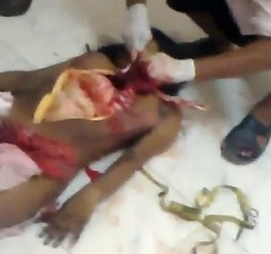 Autopsy Young Indian Female On The Floor