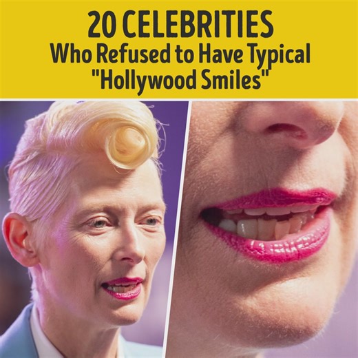 20 Celebrities Who Refused to Have Typical "Hollywood Smiles" | Bright Side